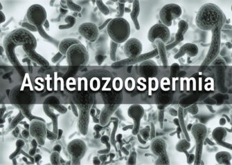 What is asthenozoospermia? – Causes, Effects, Diagnosis & Treatment options